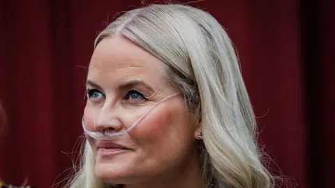 Getty Images A headshot of Mette-Marit wearing a breathing tube connected to an oxygen device