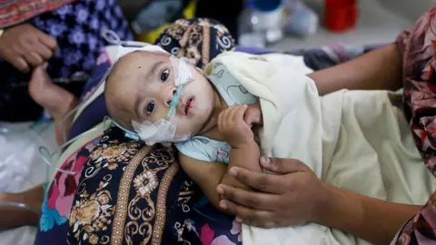 Getty Images A child looks at the camera, lying on a woman's lap, with tubes inserted into his nose.
