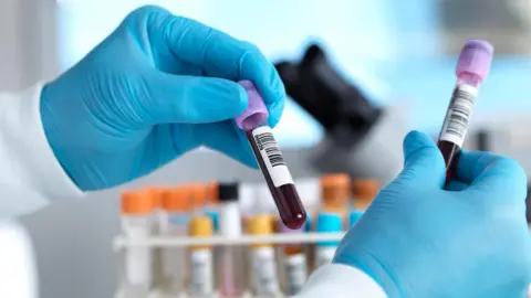 Getty Images Two gloved hands hold vials of blood. Several vials in a rack can be seen in a blurred background.