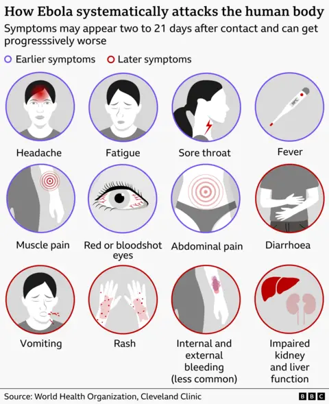 A graphic explaining the different symptoms of Ebola and how it attacks the human body