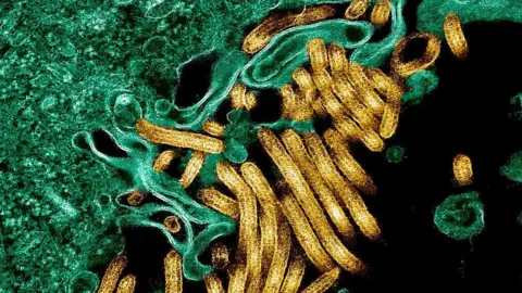 Universal Images Group via Getty Images Colorised transmission electron micrograph of Ebola virus particles (in gold) with other cells in green