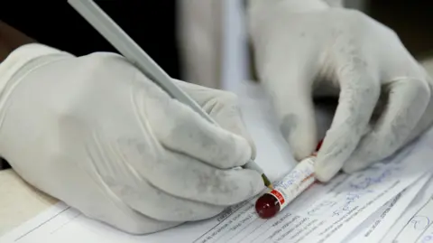 Reuters Close-up of a doctor's white-gloved hands as they write on a vial that is filled with blood at a local government hospital in Harare, Zimbabwe - 2020.