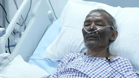 Hillary Dawa Sherpa lying on the hospital bed
