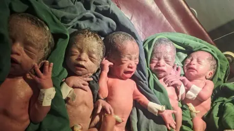 Hiwot Fana Specialised Hospital Five babies close up in hospital, placed on green sheets. They are still covered in residue from their births.