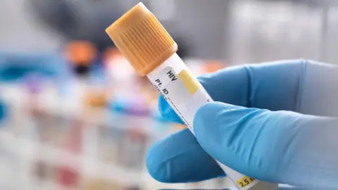 Getty Images A stock image of a blue gloved hand holding a vial with HIV written on the label