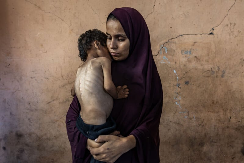 A woman in a purple headscarf holds a malnourished child against a cracked, beige wall. The child’s ribs are visible, and both appear somber and weary.