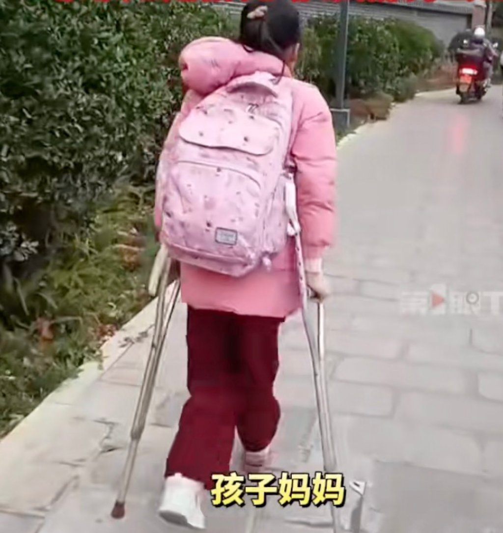 Jiajia, above, experienced a serious road accident in 2016, which left both of her feet severely injured and part of her left foot was amputated. Photo: Douyin