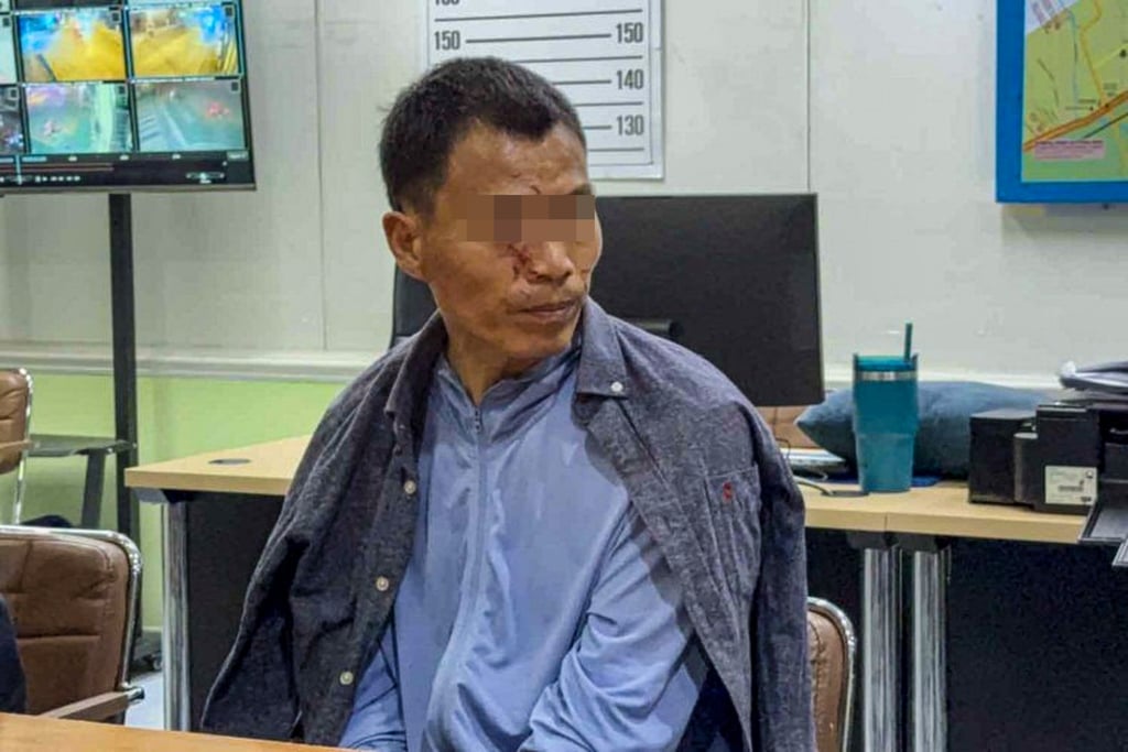 A Chinese suspect, identified by Thai police as Fu Tongyuen, is seen with scratches on his face, apparently inflicted during a violent struggle. Photo: Handout