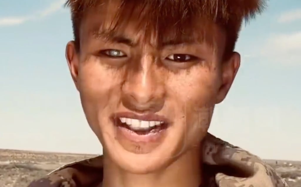 Wang Jin was injured by the branch of a tree in his younger days which left him with distinctive mismatched eyes. Photo: Weibo