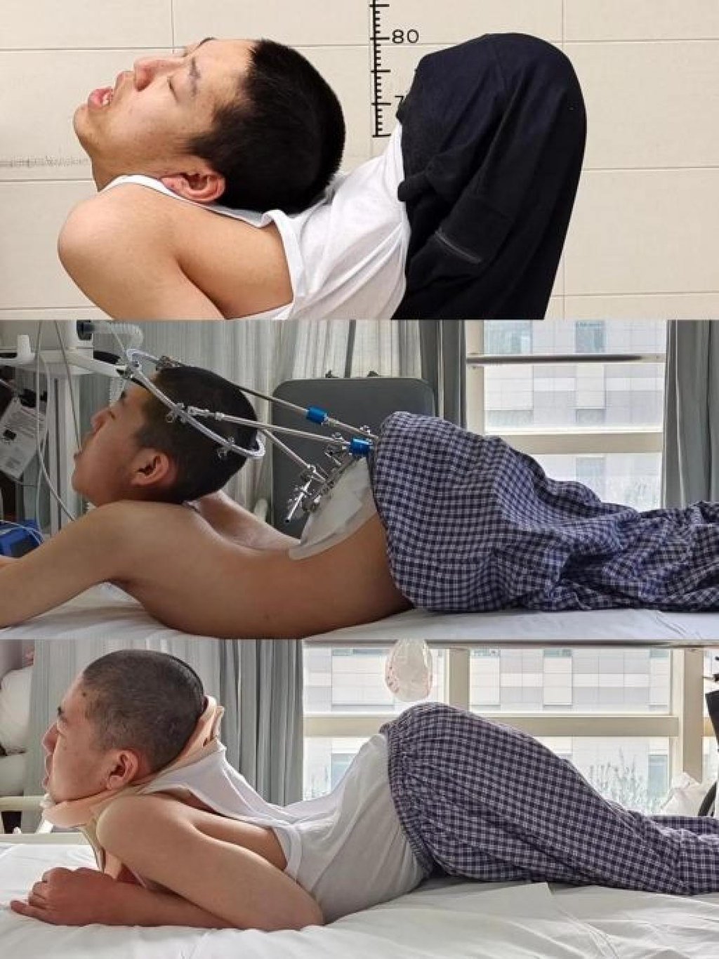 Years of surgery and rehabilitation required Jiang to show incredible persistence. Photo: Handout