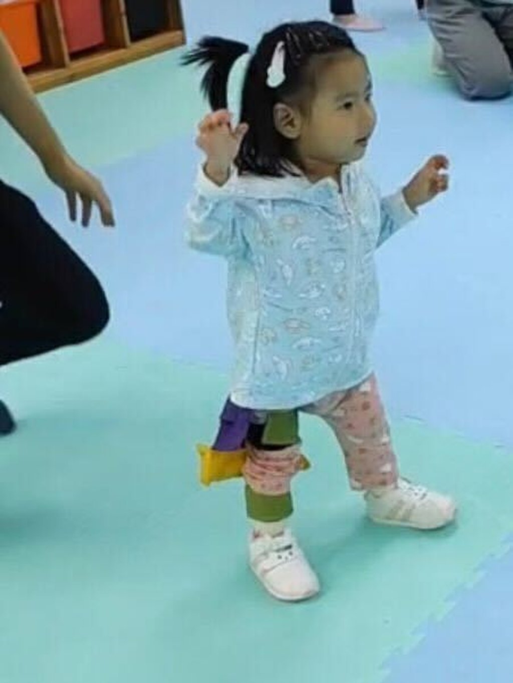Unlike other children her age, Suet-yee cannot walk by herself and both sides of her body must be held to take a few steps. Photo: Family of Little Suet-yee