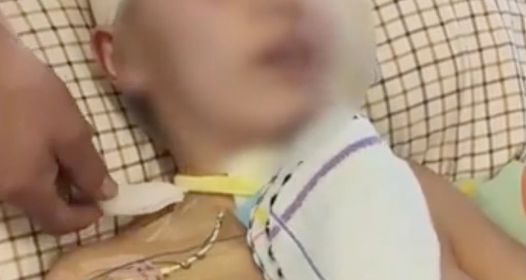 Yuanyuan suffered severe injuries, including head trauma, facial injuries, and multiple bone fractures, leading to a deep coma after a craniotomy. Photo: Baidu