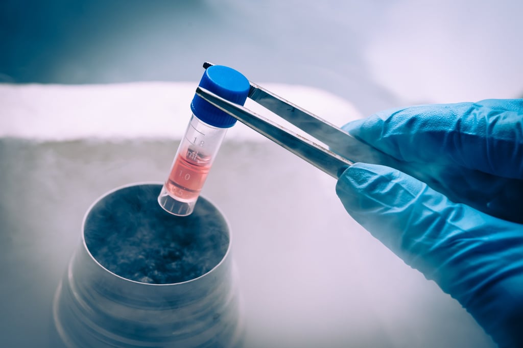 Chinese medical experts have created an ultra-efficient stem cell treatment for Parkinson’s disease that has achieved remarkable results in clinical trials. Picture: Shutterstock Images