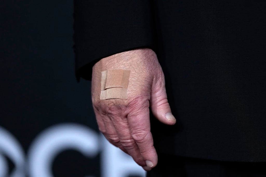 A bandage is seen on the hand of US President Donald Trump while he walks the red carpet at the Kennedy Centre in Washington in December. Photo: AP