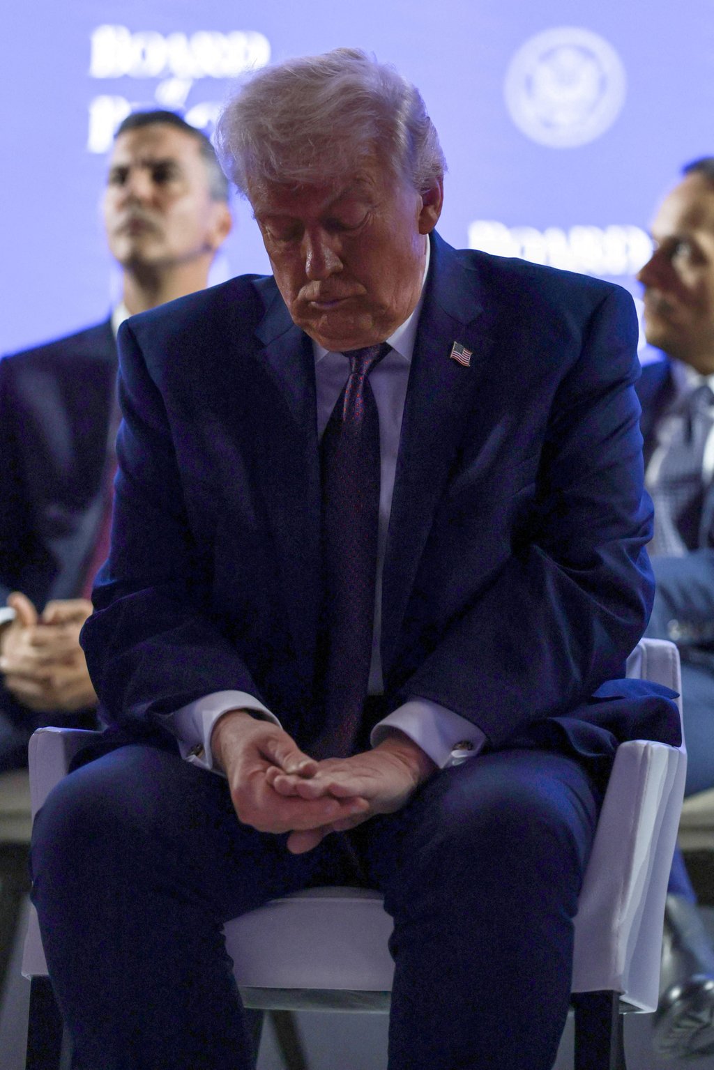 US President Donald Trump looks at his bruised hand. Photo: Reuters