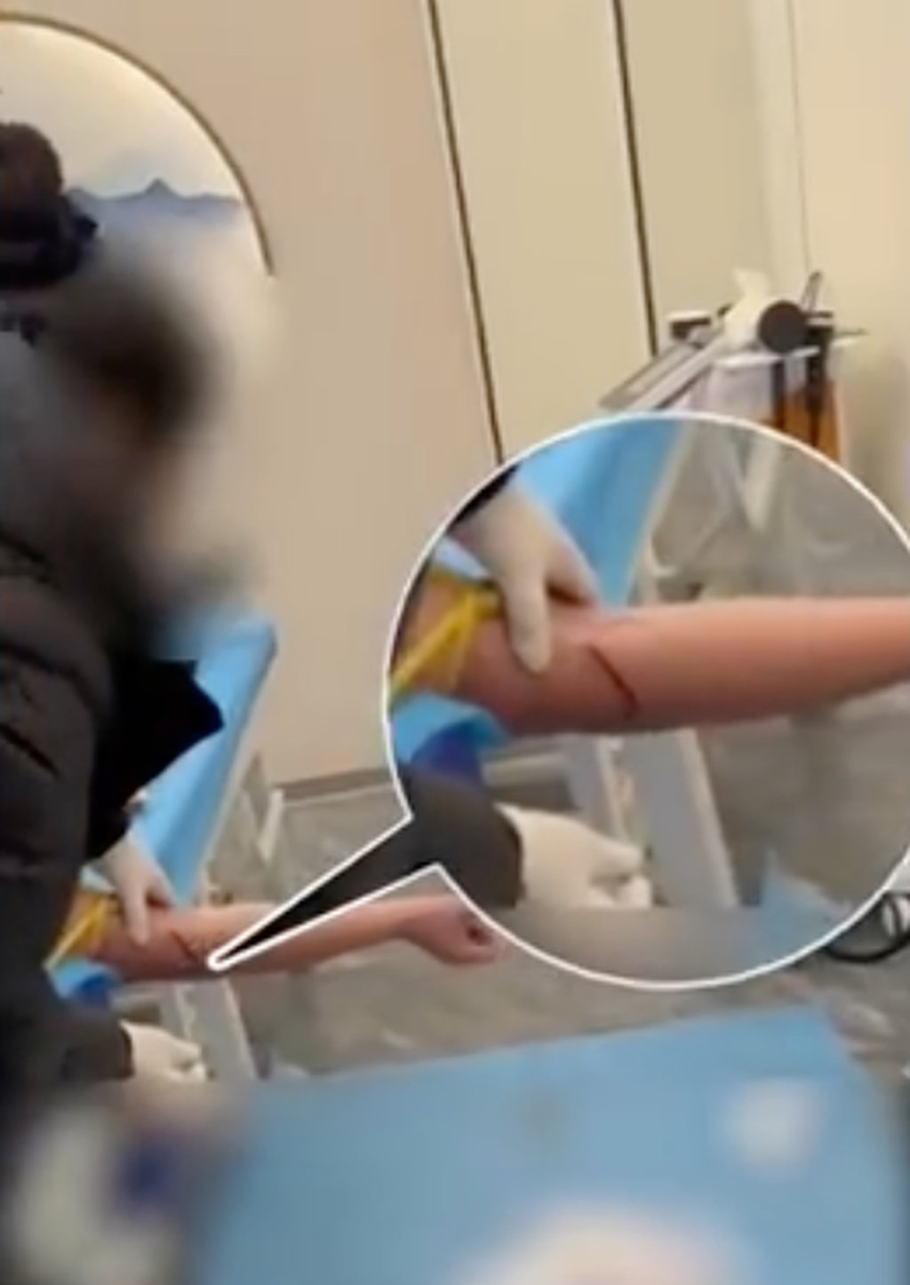 Seconds after the “treatment” gets under way, blood can be seen dripping from the man’s arm. Photo: Weibo