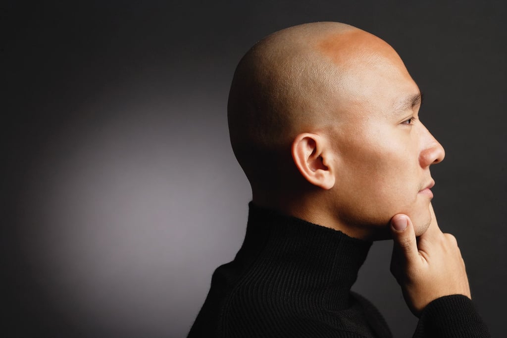 Li had been wanting to have a normal scalp for years — much like the man pictured above — having suffered from severe psychological stress and confidence issues since his teenage years. Photo: Shutterstock