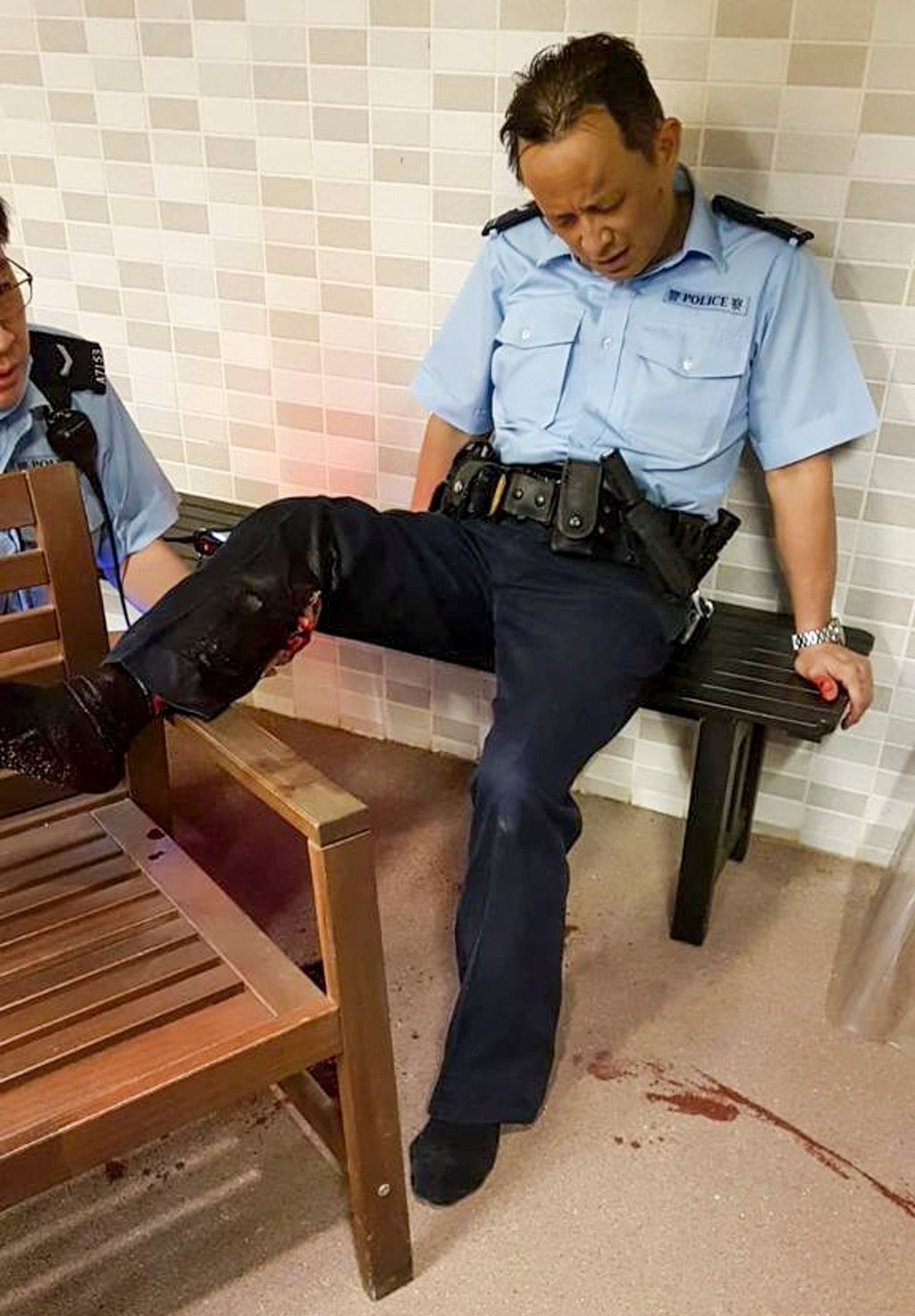 A policeman was bitten in the right calf by a wild boar in November 2021. Photo: FACEBOOK.