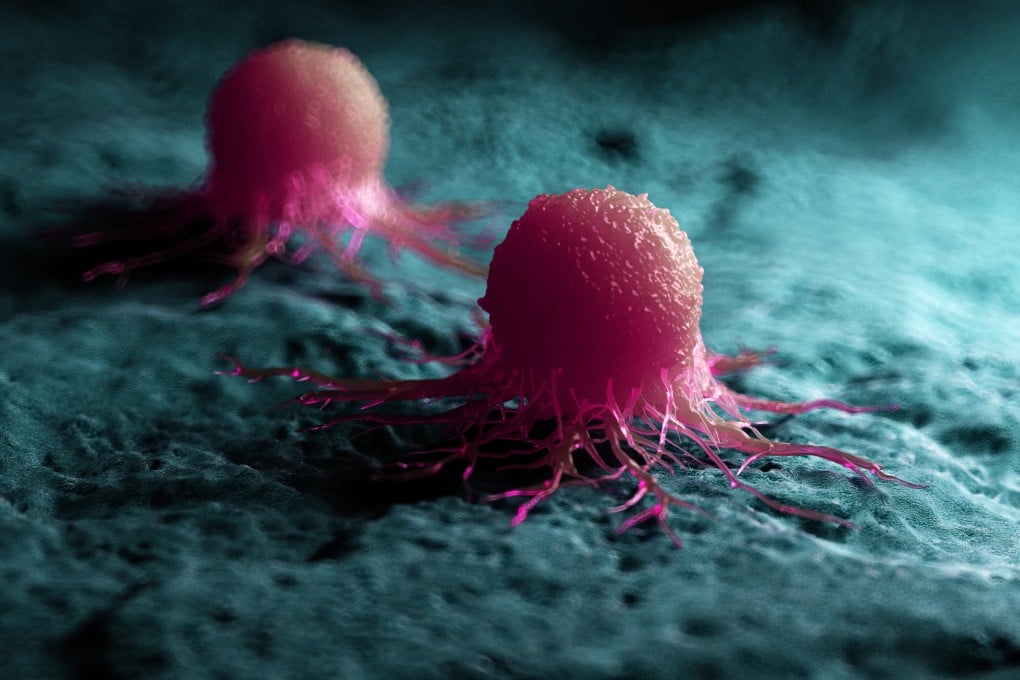 A pioneering new cancer treatment tricks the body into thinking tumours are pig cells which leads to an immune response which targets the cancer cells. Photo: Shutterstock