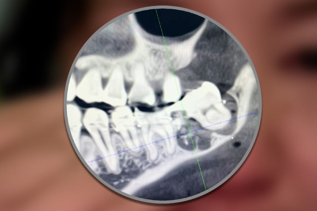 A woman in China who suffered “immense” pain after a botched tooth extraction has died after plunging from a hospital roof. Photo: SCMP composite/Douyin