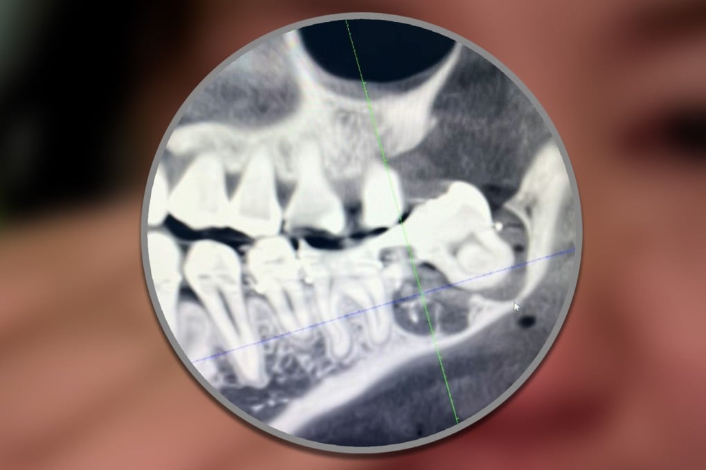 A woman in China who suffered “immense” pain after a botched tooth extraction has died after plunging from a hospital roof. Photo: SCMP composite/Douyin