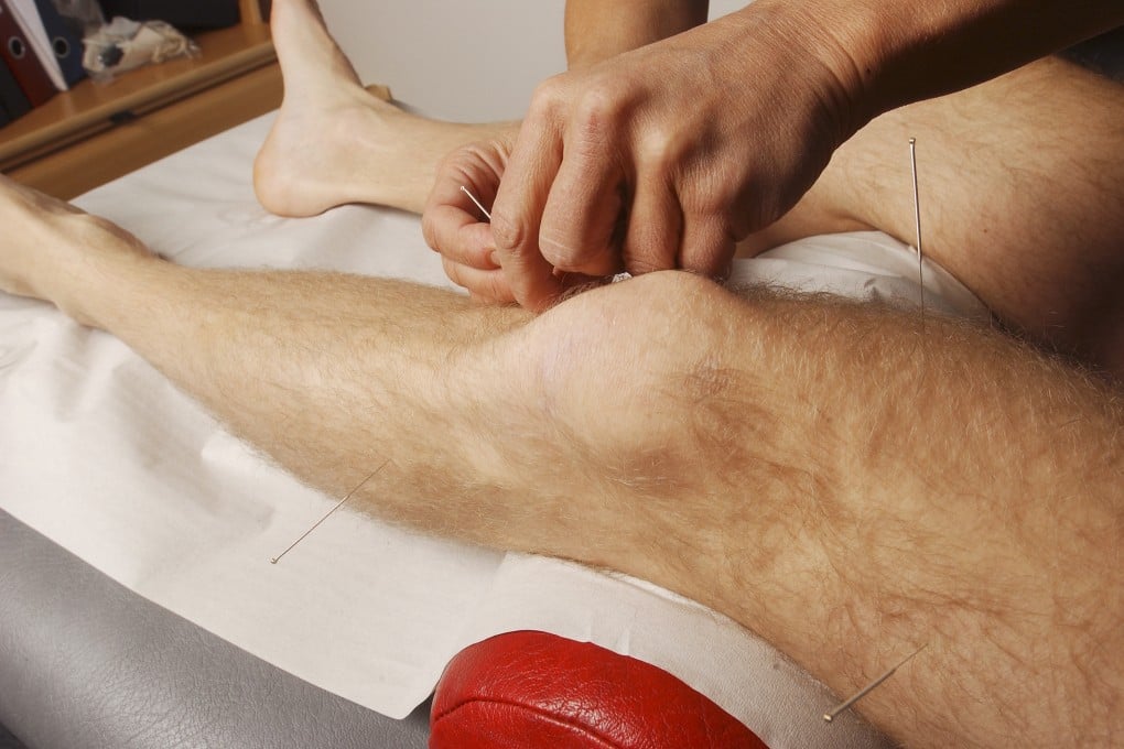 A Hong Kong man has suffered a flesh-eating infection after an acupuncture treatment, which has led to the amputation of his left leg. Photo: Getty Images