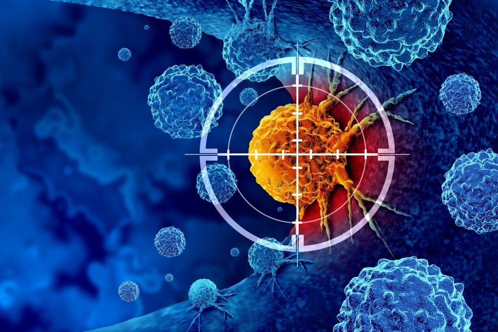 Radiation therapy is often used alone or in combination with surgery and chemotherapy to control the growth of localised cancer tumours. Illustration: Shutterstock