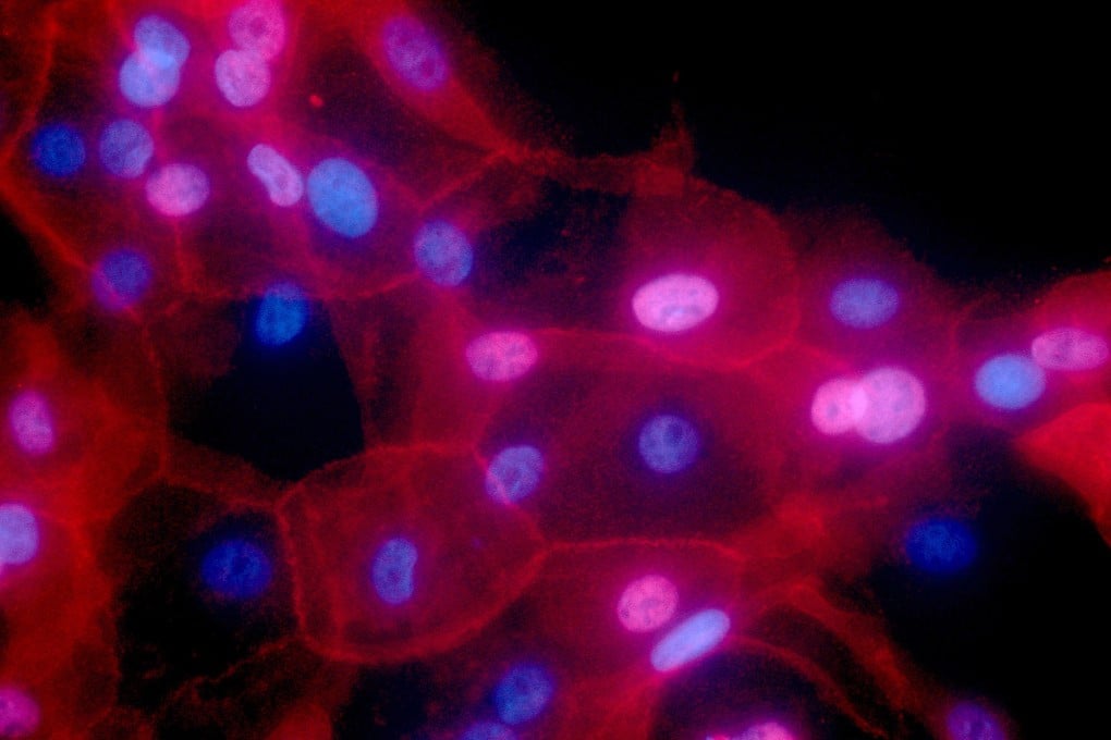 Team based in China also finds that the use of specific drugs in combination with chemotherapy could be used to inhibit this process in mice, with a clinical trial already under way in breast cancer patients. Photo: AP