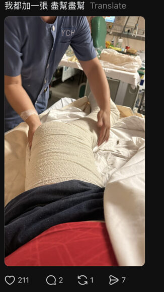 醫護人員為傷者包紮傷口.