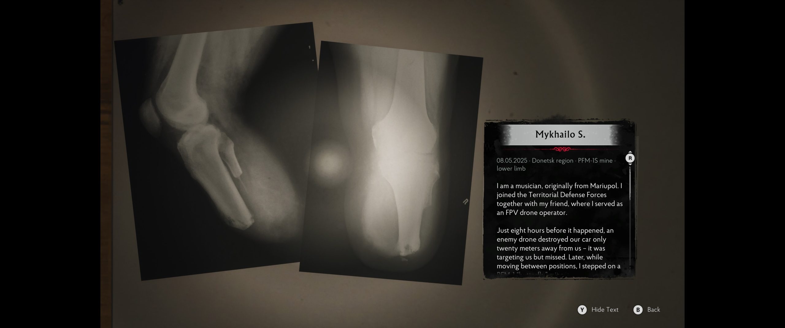 An in-game screen from Mykhailo S. showing X-ray images of a lower limb and a diary entry detailing an encounter with a drone strike in the Donetsk region on 08.05.2025.